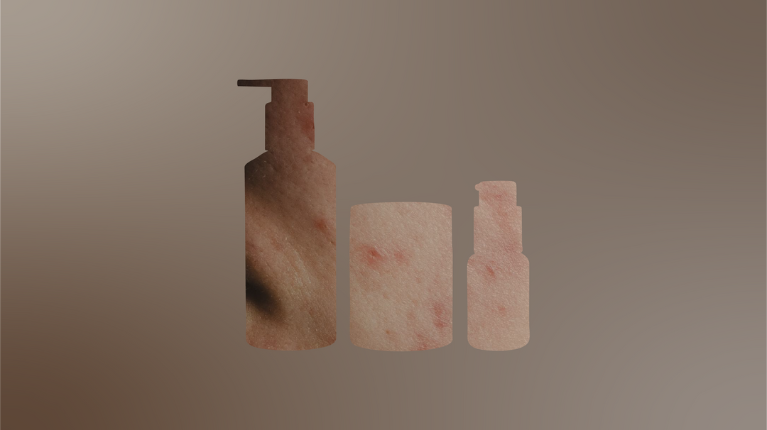 The Inflammation Paradox: We Reduce Inflammation Everywhere… Except Our Skin
