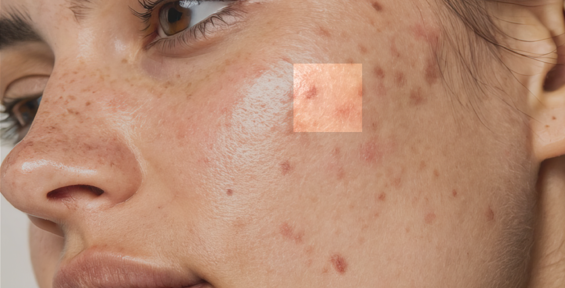 How Skin Inflammation Accelerates Aging (More Than Wrinkles Do)