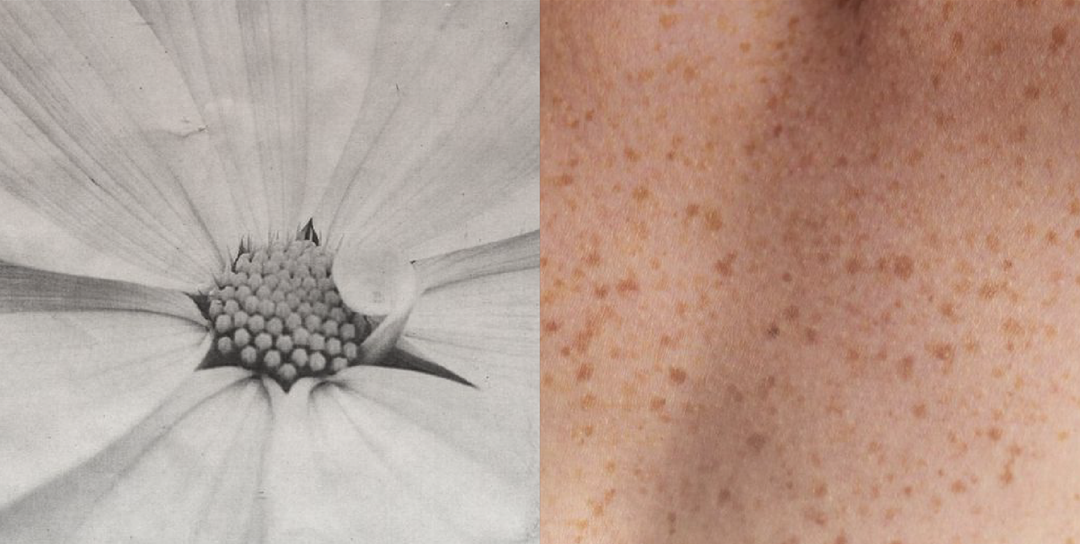 Beauty in Balance — Why the Microbiome Matters