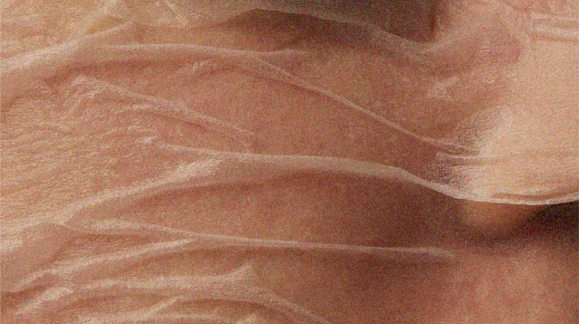 "Ozempic Face": What It Really Means for Your Skin (and How to Support It)