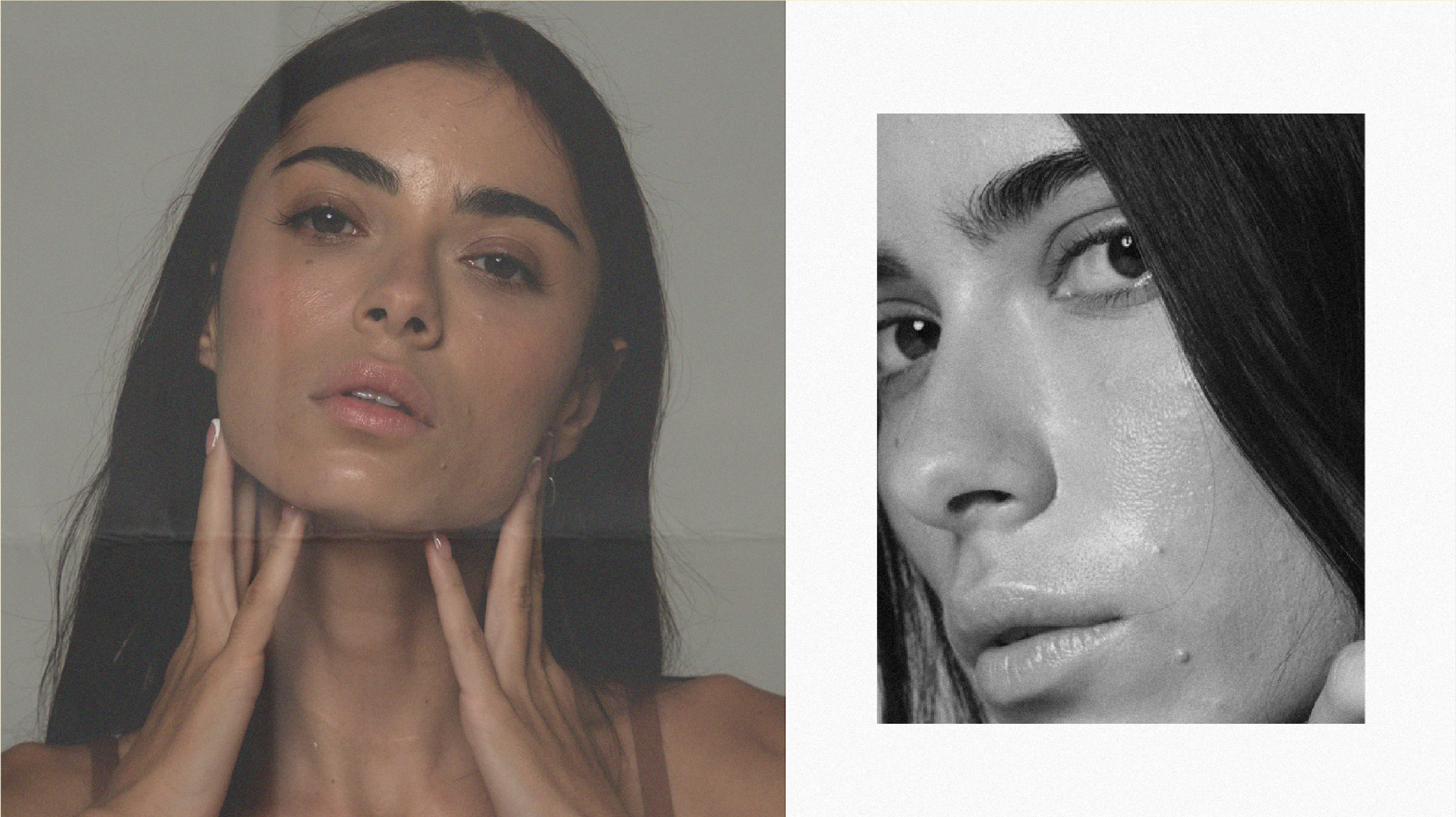 Is "Cortisol Face" Real? A Dermal Therapist Explains