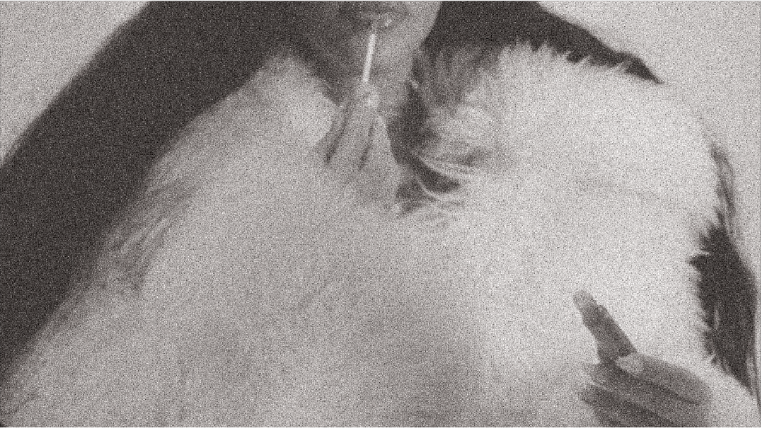 Person wrapped in a warm coat in winter, illustrating how skin needs a protective barrier in cold weather